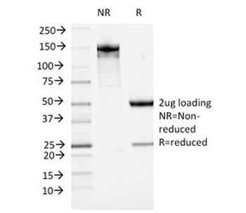 ATRX Antibody / RAD54