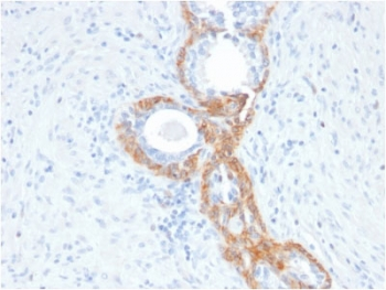 Basic Cytokeratin Antibody