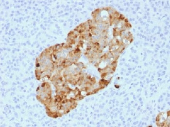 Chromogranin A Antibody