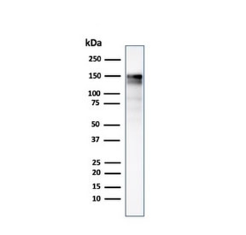 EGF Receptor / EGFR Antibody