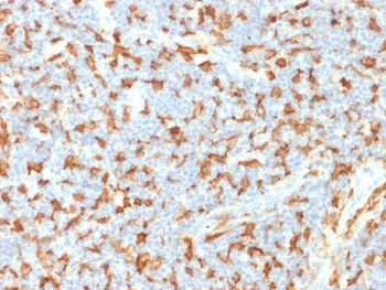 IBA1 Antibody / AIF-1