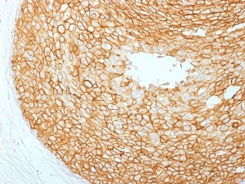 HER2 Antibody / ErbB2