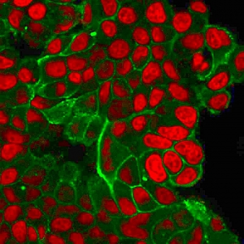 HER2 Antibody / ErbB2
