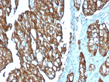 TROP2 Antibody