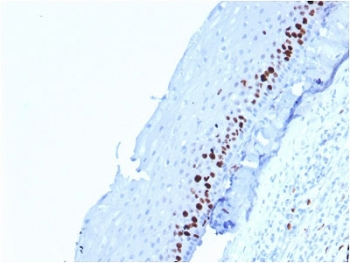 Ki67 Antibody