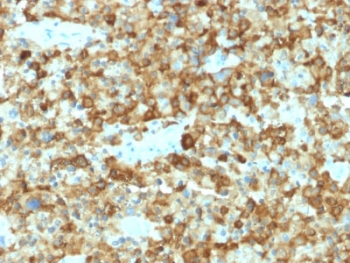 PMEL17 / Melanoma gp100 Antibody