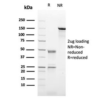CD21 Antibody