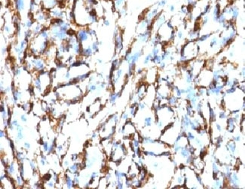 Alpha Actin Antibody / ACTA2 (smooth muscle)