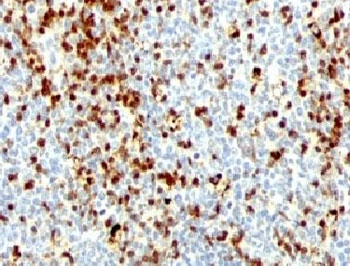 ZAP70 Antibody