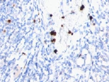 Myeloid Marker / MYADM Antibody