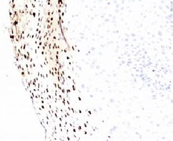 HPV-16 L1 Antibody