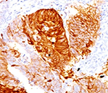 ALDH1A1 Antibody / Acetaldehyde dehydrogenase 1