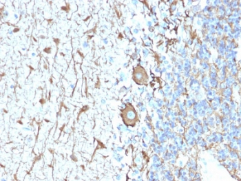 Neurofilament Antibody (-Heavy) / NF-H / NEFH