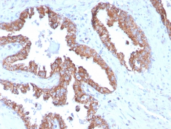 TMEPAI Antibody / PMEPA1