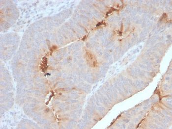Serum Amyloid A Antibody / SAA1 + SAA2