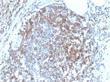 CD6 Antibody