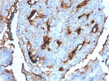 CDC34 Antibody / UBC3B