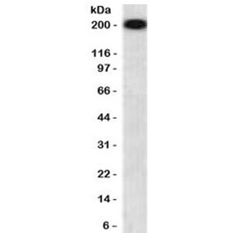 Neurofilament Antibody (-Heavy) / NF-H / NEFH