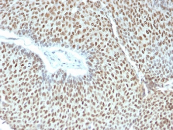 Phospho-JUN Antibody (pT91/93)