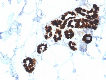 KRT15 Antibody / Cytokeratin 15