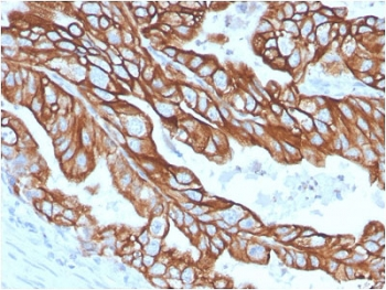 Cytokeratin 18 Antibody
