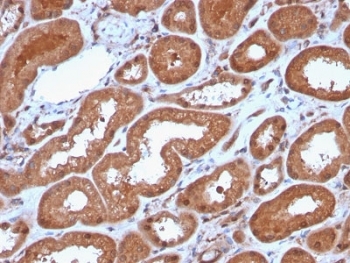 MTAP Antibody