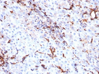 Cathepsin K Antibody / CTSK