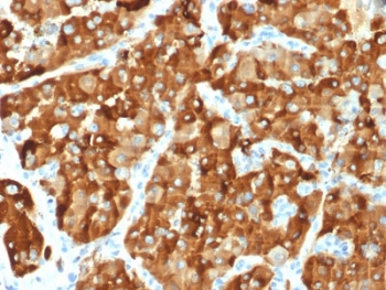 AMACR / p504S Antibody (Prostate Cancer Marker)