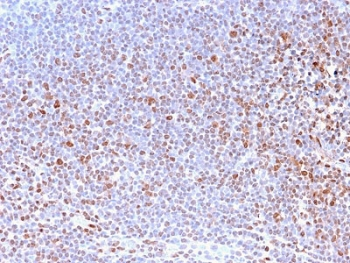Nuclear Antigen Antibody