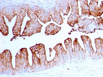 Folate Hydrolase 1 Antibody / FOLH1 / PSMA