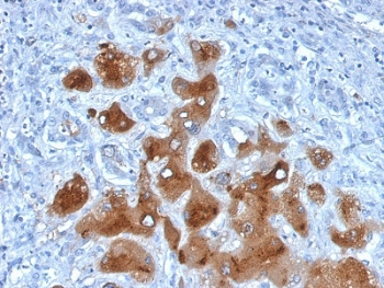 Serum Amyloid A Antibody / SAA1 + SAA2
