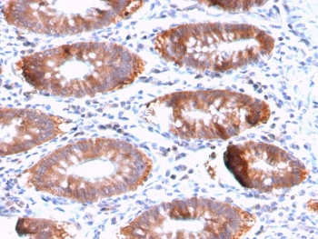Aurora B Antibody / AURKB
