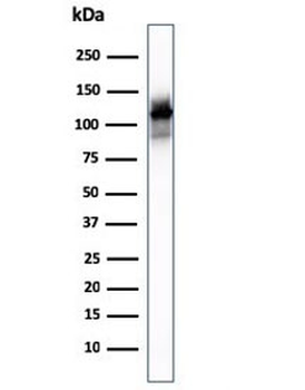 ACTN2 Antibody / Alpha Actinin 2 / Sarcomeric Alpha Actinin