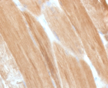 Dystrophin Antibody / DMD