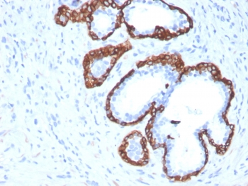 Cytokeratin 5 Antibody / KRT5