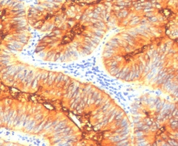 MUC4 Antibody / Mucin-4