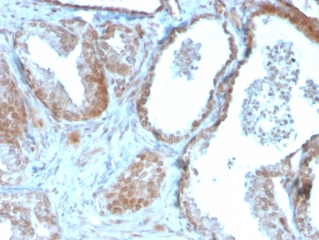 TIGIT Antibody / VSTM3 / VSIG9