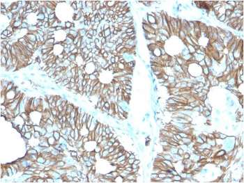 Cadherin 17 Antibody