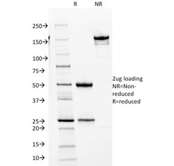 CDK2 Antibody