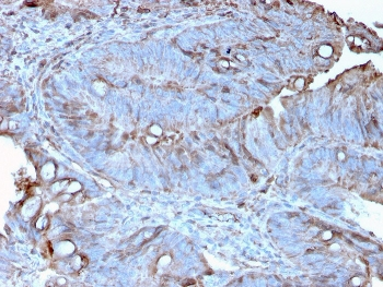 MerTK Antibody