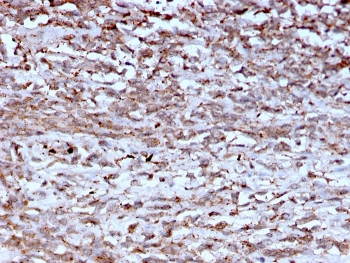 Cathepsin K Antibody / CTSK