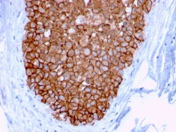HER2 Antibody / ErbB2
