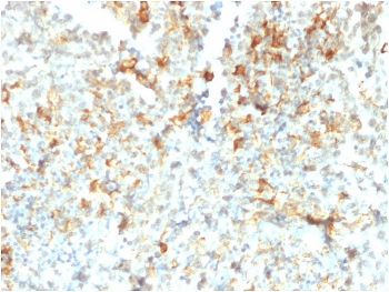 FCGRT Antibody