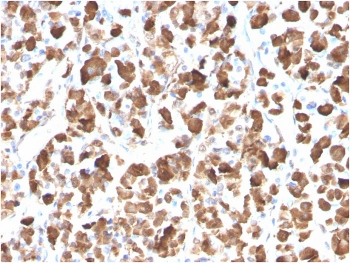 Growth Hormone Antibody / GH1