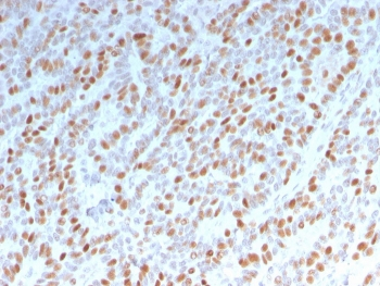 Estrogen Receptor alpha Antibody