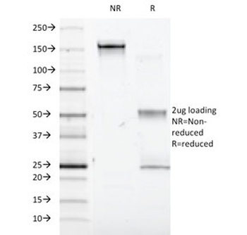 Interferon alpha 1 Antibody / IFNA1