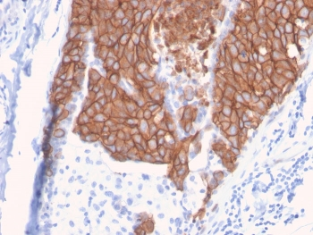 HER2 Antibody / ErbB2