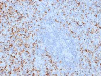 Integrin beta 3 Antibody / ITGB3 / CD61