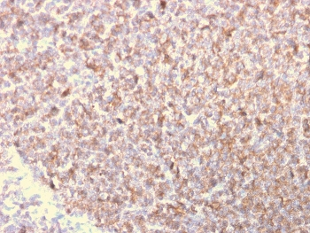 LSP1 Antibody / Lymphocyte Specific Protein 1