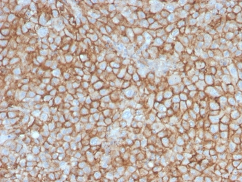 CD146 Antibody / MCAM / MUC18